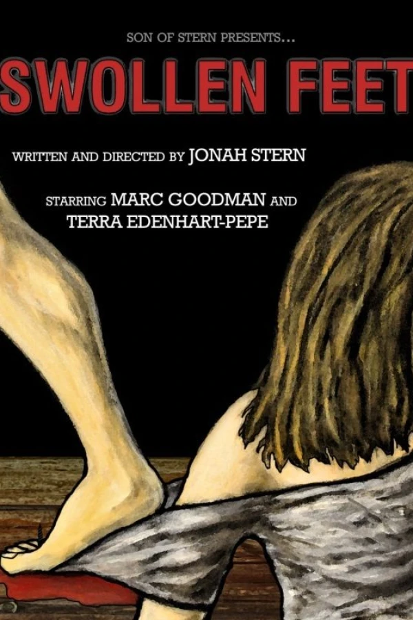 Swollen Feet Poster