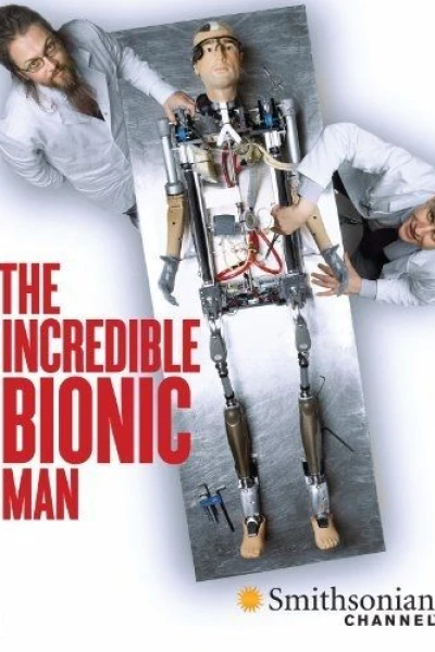 How to Build a Bionic Man
